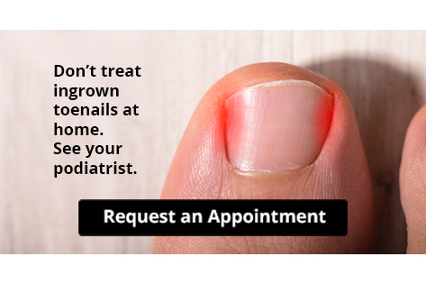Try this life-changing product for thick toenails: Central Massachusetts  Podiatry: Podiatrists