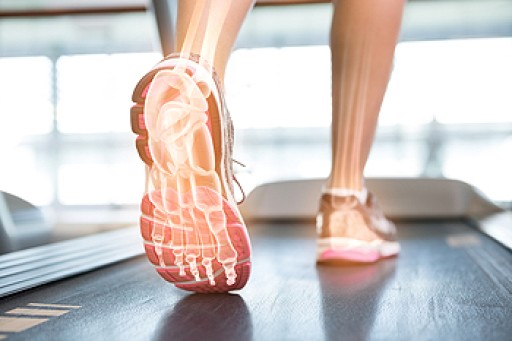 Dealing with Stress Fractures of the Foot and Ankle